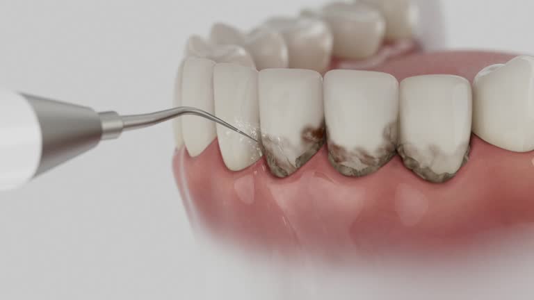 Trusted Dental Implants service in Coloma, MI - Dentist Open Now